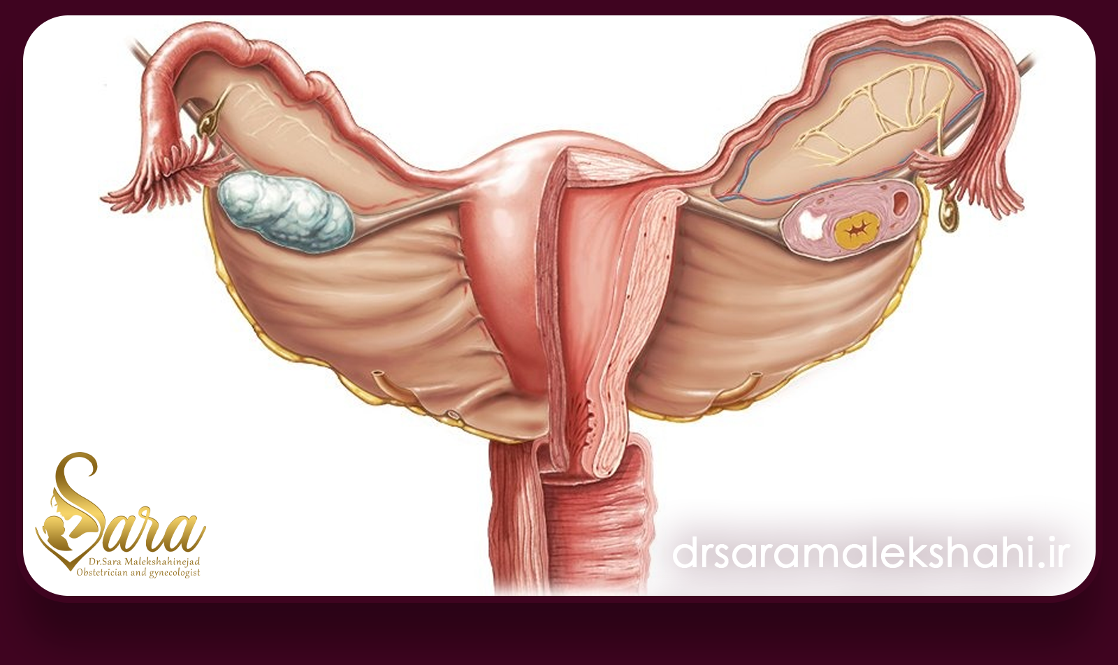 درمان دارویی افتادگی رحم